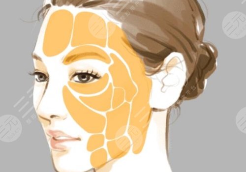 填充面部整形要多少钱