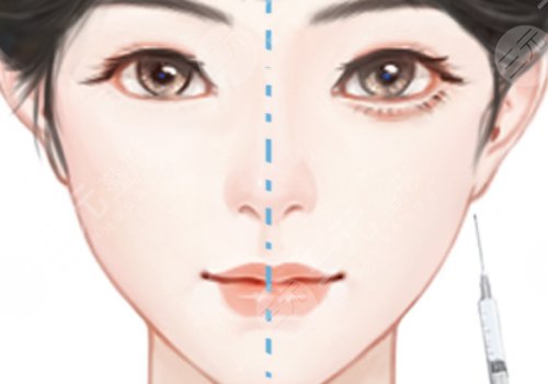 郑州美眼整形医院造卧蚕怎么样