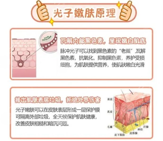 北京赵海月医生光子嫩肤案例
