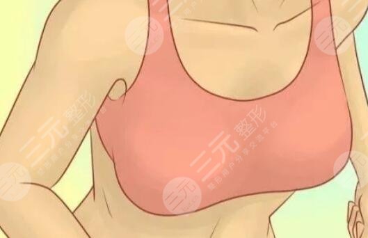 隆胸