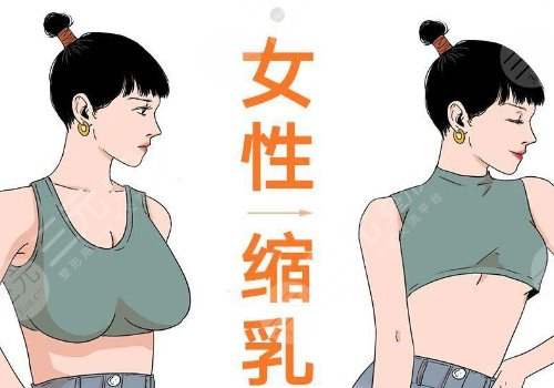 缩胸手术真实案例前后对比图案例分享