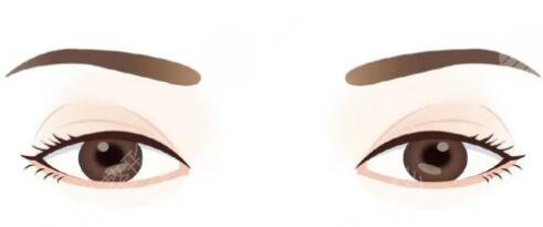 双眼皮修复