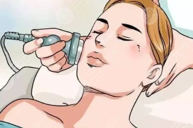 激光美肤