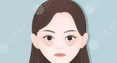 祛眼袋哪种手术好？3种不同方案对比，眼部整形必看指南！