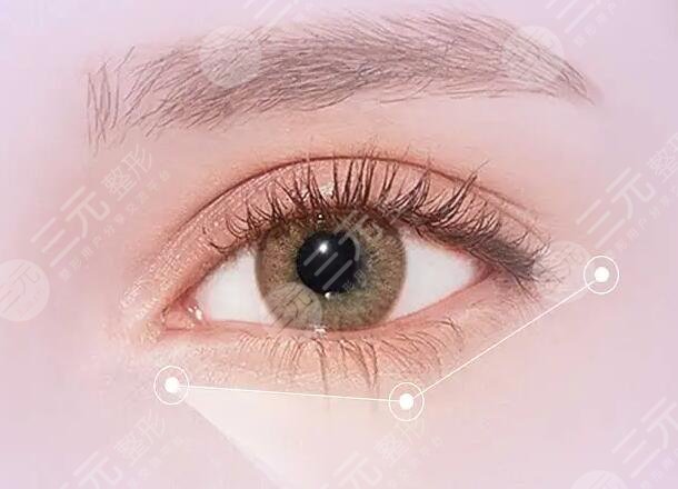 长春赵自然做修复双眼皮怎么样？手术要排多久？资料、实力、案例简介