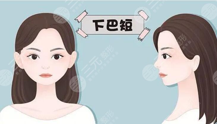 短下巴