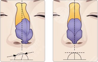北京余若晖医生简介\简历
