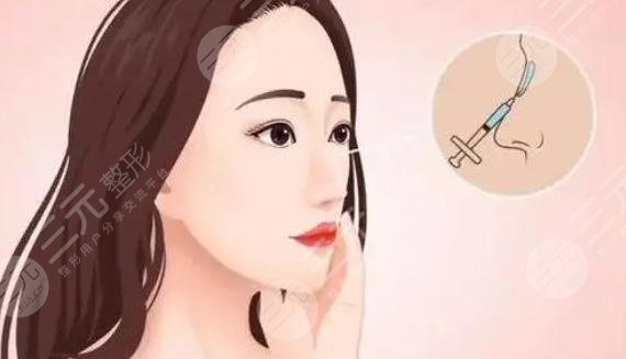 武汉卓美整形医院王海平医生