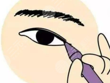 双眼皮修复