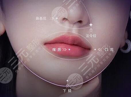 psv面部提升是拉皮吗?是什么一种技术?和拉皮的区别大吗?