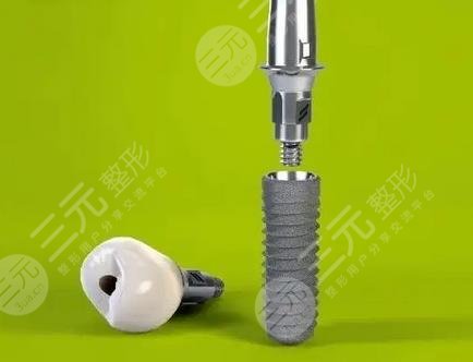 上海第十人民医院种植牙的价格怎么样