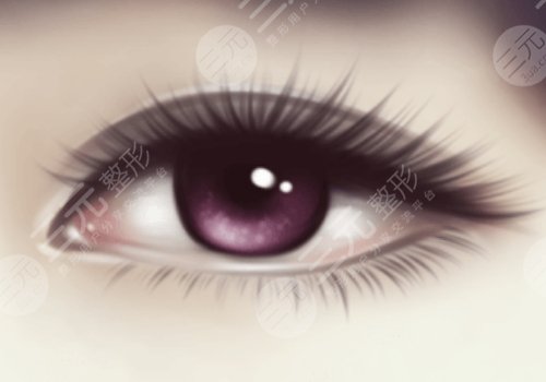 敖健飞做双眼皮自然吗