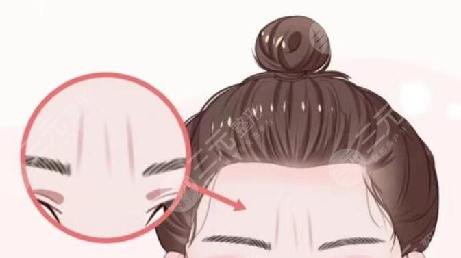 川字纹