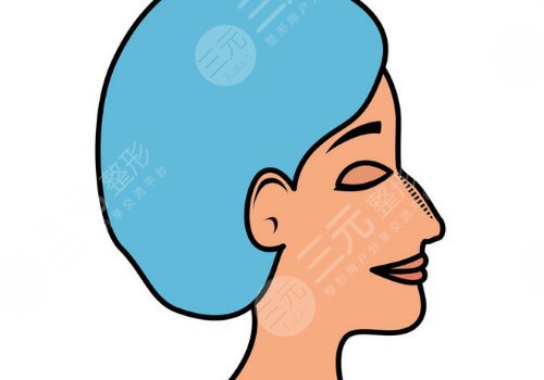 上海九院驼峰鼻哪位大夫做的好