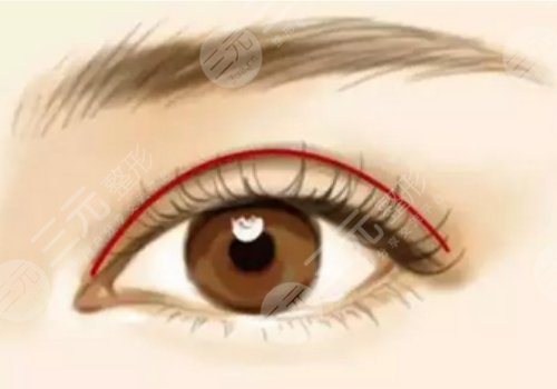 新乡市中心医院双眼皮手术价格