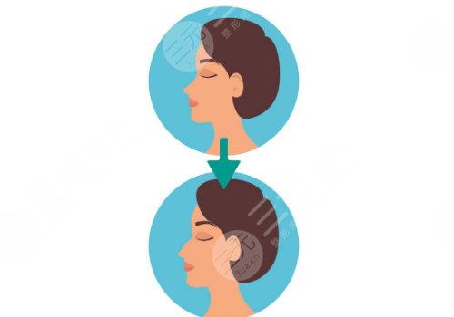 轮廓固定怎么做