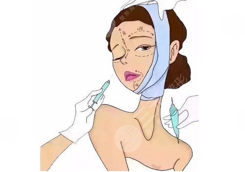 轮廓固定怎么做