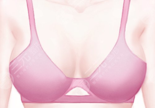 上海九院做乳房下垂松弛手术多少钱