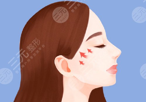 颧骨内推多少钱