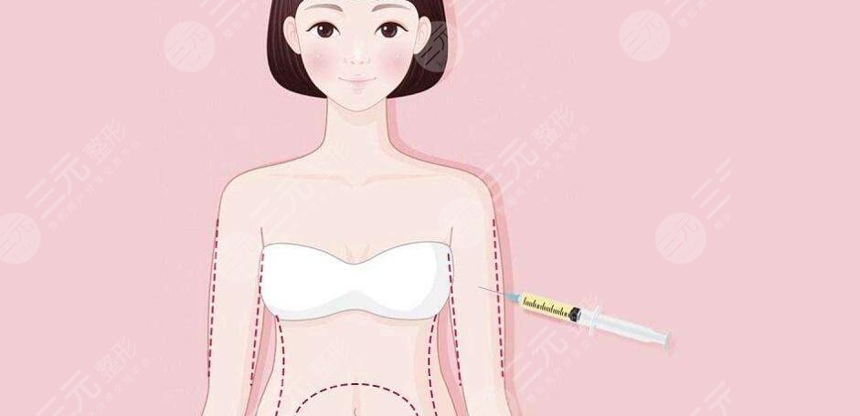 手臂吸脂