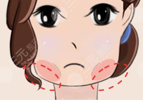 上海伊莱美削骨怎么样