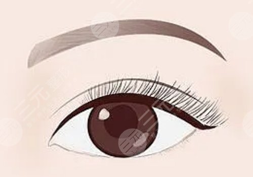 许莲姬双眼皮多少钱