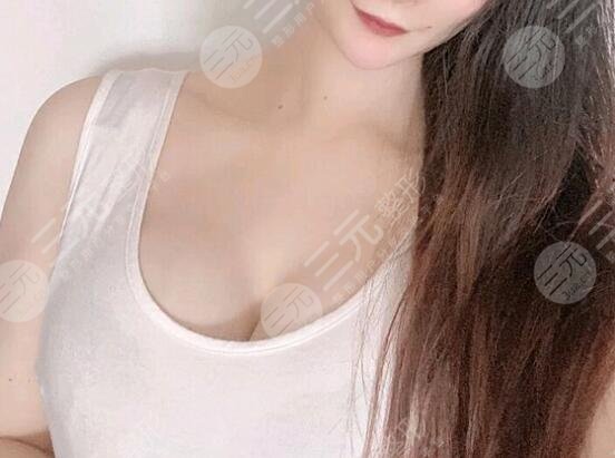 水滴型假体隆胸前后对比效果图片和手术过程分享,小白隆胸避坑!