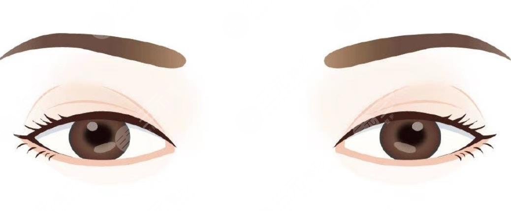 双眼皮
