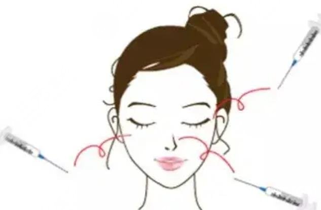 注射美容