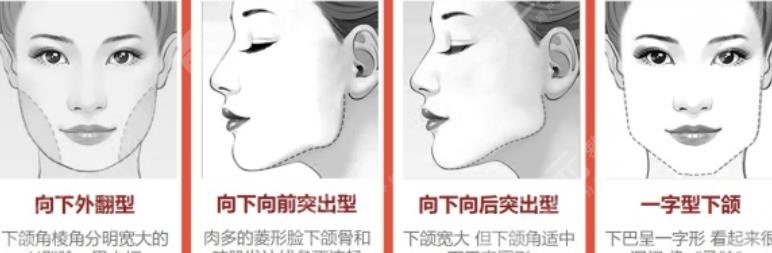 磨骨