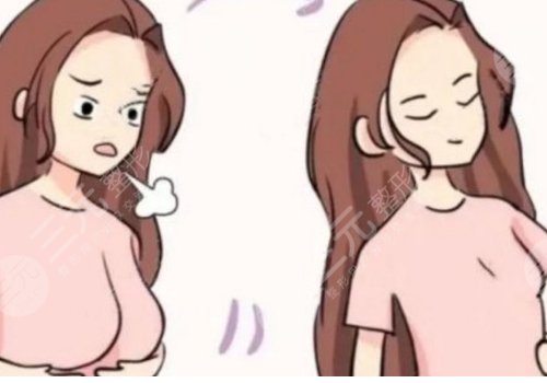 做缩胸手术需要多少钱