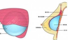 内窥镜隆胸和普通隆胸有什么区别？技术优势对比讲解，教你选择！