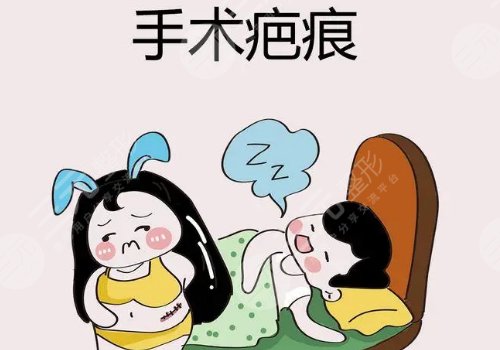 臧梦青疤痕切除缝合