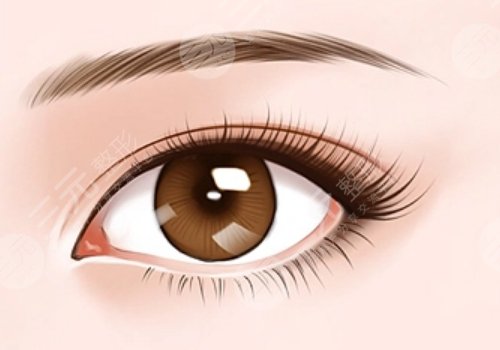 敖健飞修复双眼皮吗