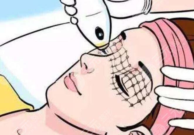 热玛吉眼部抗衰