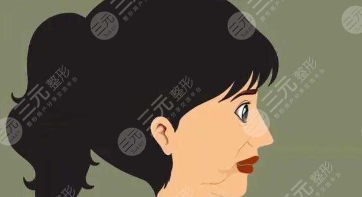 拉皮
