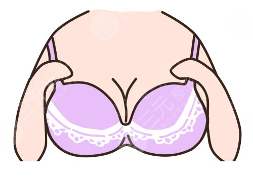 乳房下垂上提手术大约多少钱