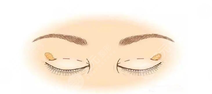 厦门脸博士做眼部综合医生