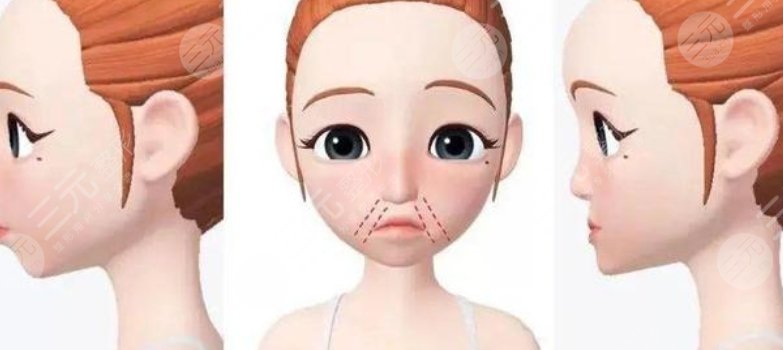 幼态脸整形案例