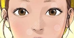 双眼皮割深了补救方法有哪些？不满意你还可以这样做