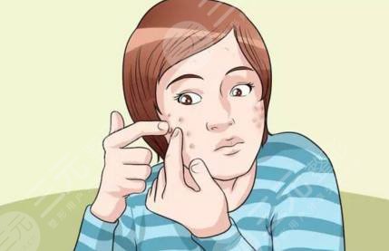 北京八大处臧梦?青专家痘坑案例