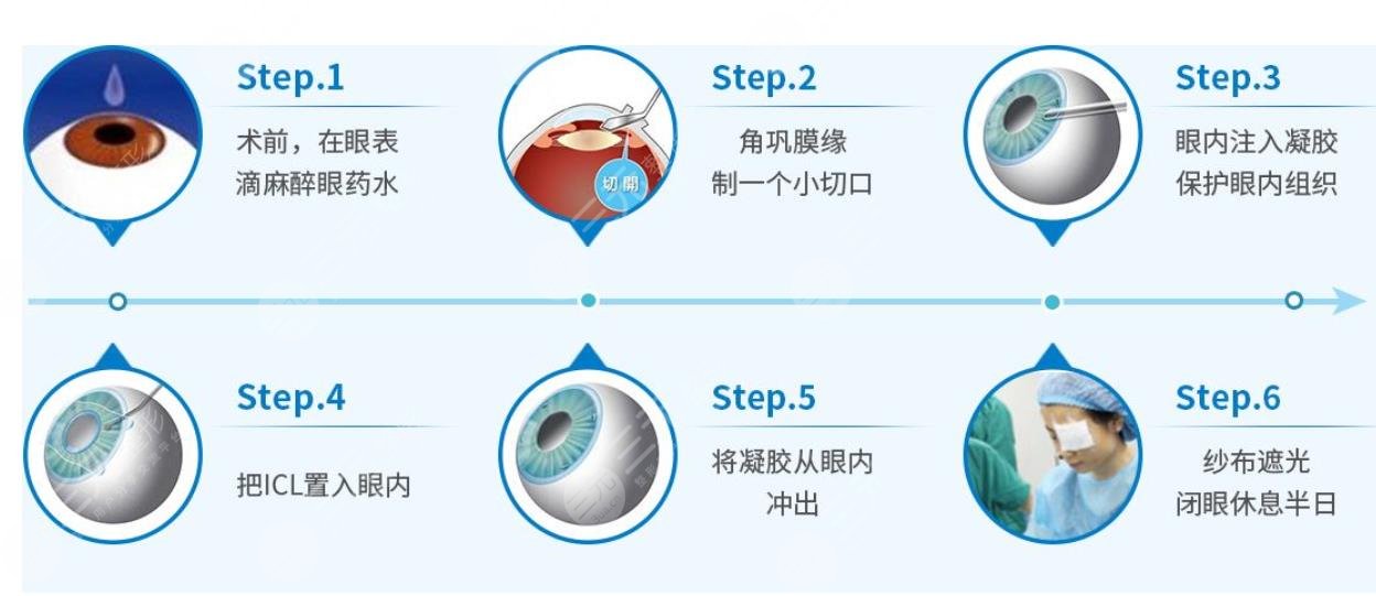 上海第九人民医院眼科专家