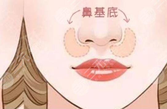 垫鼻子