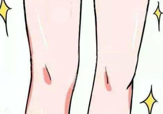 祛疤