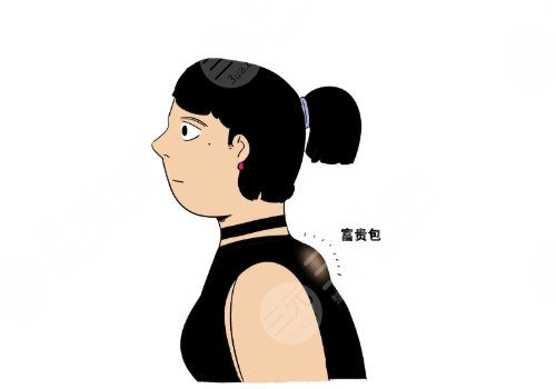 上海第九人民医院富贵包看什么科 