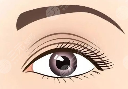 武汉付冰川双眼皮如何