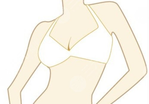 九院徐华乳腺癌假体重建图片