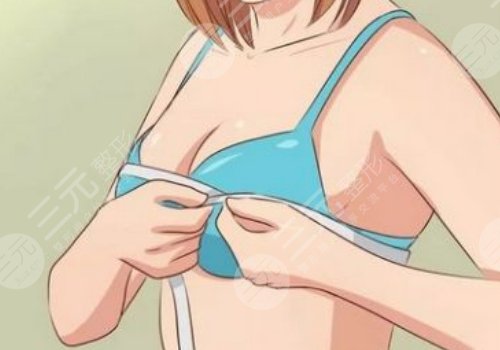 九院徐华乳腺癌假体重建图片