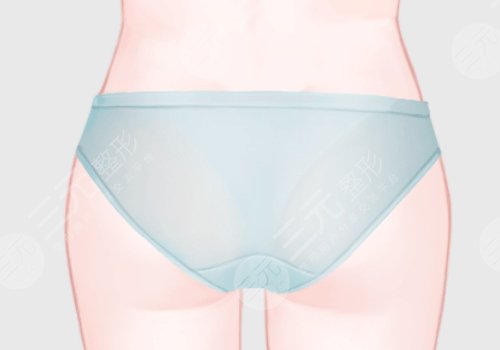 上海第九人民医院假体丰臀的医生有哪些?