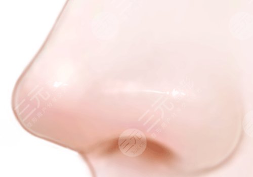 上海第九人民医院歪鼻矫正要多少钱